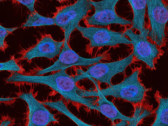 Click image for larger version  Name:	Low-Res_national-cancer-institute-jdfn7Z03Qa4-unsplash.jpg Views:	0 Size:	178.1 KB ID:	325404