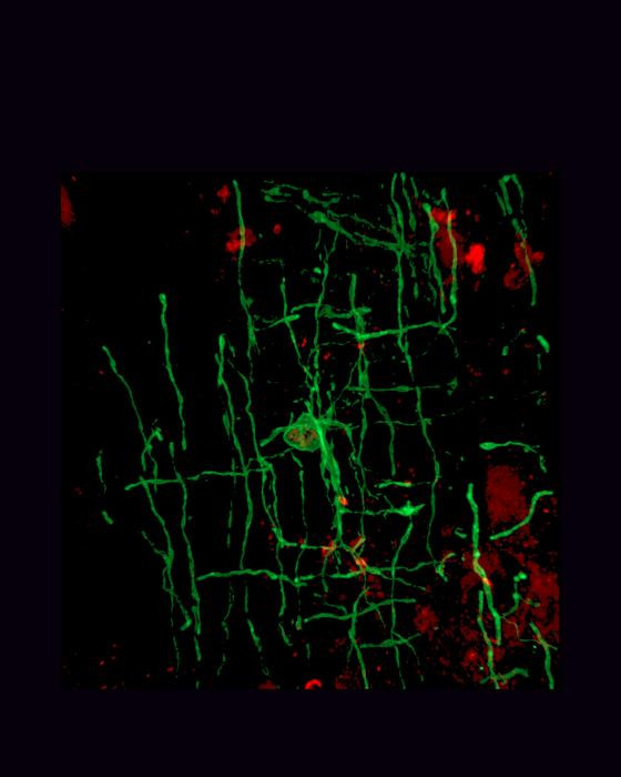 Click image for larger version

Name:	Low-Res_A myelinating oligodendrocyte (green) CREDIT Peggy Assinck Altos Labs-Cambridge Institute of Science.jpg
Views:	234
Size:	65.8 KB
ID:	325491