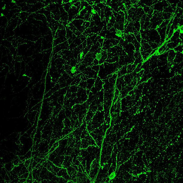 Click image for larger version

Name:	Low-Res_Neuroni della corteccia prefrontale che producono CRF visti al microscopio a fluorescenza_24099.jpg
Views:	168
Size:	242.0 KB
ID:	326325
