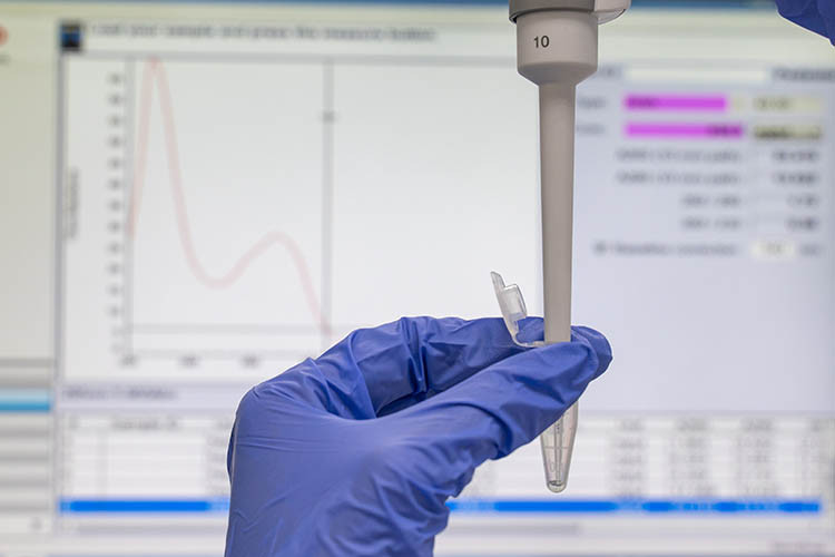 The latest advances in reagents and protocols are helping reduce variability from collection, preservation, and sample preparation.