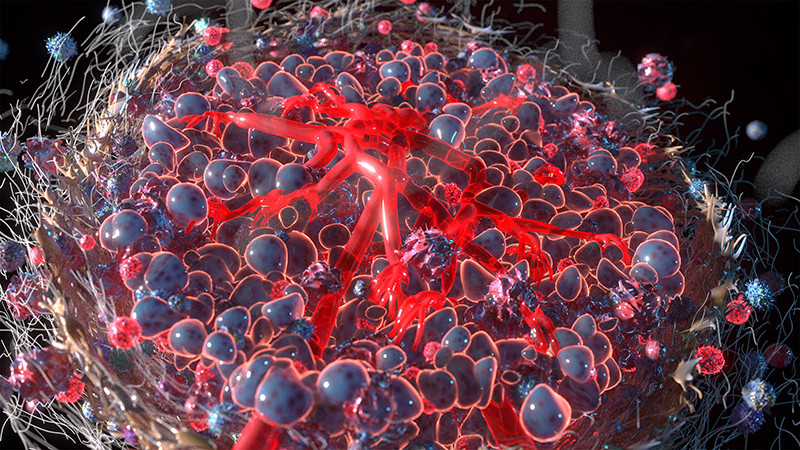 The power of single-cell analysis for understanding drug resistance in cancer is clear, but by disaggregating tissues, they miss one crucial aspect: the tumor microenvironment.
